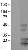 KCNE1L (KCNE5) Human Over-expression Lysates NM_012282