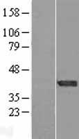 Carbonic Anhydrase XIV (CA14) Human Over-expression Lysates NM_012113