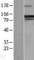 GADD34 (PPP1R15A) Human Over-expression Lysates NM_014330