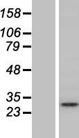 Syntaxin 12 (STX12) Human Over-expression Lysates NM_177424
