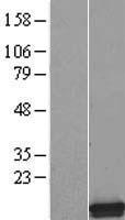 SMPX Human Over-expression Lysates NM_014332