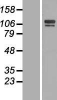 SH3BP4 Human Over-expression Lysates NM_014521