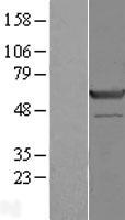 SGK3 Human Over-expression Lysates NM_001033578