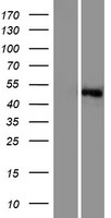 SGK3 Human Over-expression Lysates NM_170709