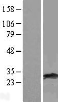 RAB38 Human Over-expression Lysates NM_022337