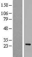 EID1 Human Over-expression Lysates NM_014335