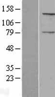 NPAP1 Human Over-expression Lysates NM_018958