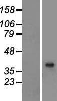 BHMT2 Human Over-expression Lysates NM_017614