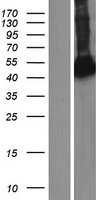 ARHGAP8 Human Over-expression Lysates NM_181335