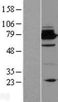 Bcl rambo (BCL2L13) Human Over-expression Lysates NM_015367