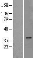 MTCH2 Human Over-expression Lysates NM_014342