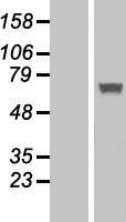 IFIT5 Human Over-expression Lysates NM_012420