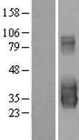 C20orf103 (LAMP5) Human Over-expression Lysates NM_012261
