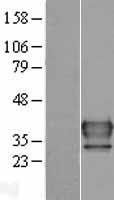 FUS2 (NAT6) Human Over-expression Lysates NM_012191