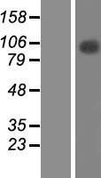 ls024144 tfip11 human over expression lysates nm 001008697 wb testing 1