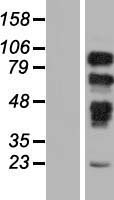 PRPF40B Human Over-expression Lysates NM_001031698