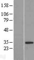 ls025770 hs747e2a c22orf31 human over expression lysates nm 015370 wb testing 1
