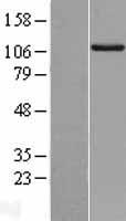 RIPK5 (DSTYK) Human Over-expression Lysates NM_015375
