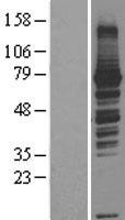 ls025780 rasgrp3 human over expression lysates nm 170672 wb testing 2