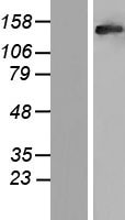 RAB3GAP2 Human Over-expression Lysates NM_012414