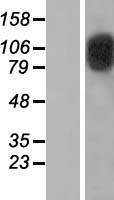 CDKN1A interacting zinc finger protein 1 (CIZ1) Human Over-expression Lysates NM_001131016