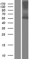 Fascin 2 (FSCN2) Human Over-expression Lysates NM_012418
