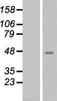 QPCT Human Over-expression Lysates NM_012413