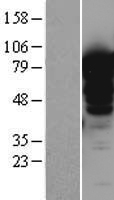 LMOD1 Human Over-expression Lysates NM_012134