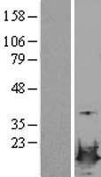 LSM4 Human Over-expression Lysates NM_012321