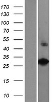 VAX2 Human Over-expression Lysates NM_012476