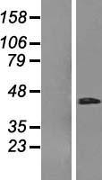 RHBDD3 Human Over-expression Lysates NM_012265