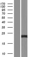 TNFAIP8 Human Over-expression Lysates NM_001077654