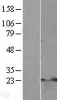 TNFAIP8 Human Over-expression Lysates NM_014350
