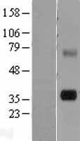TPSG1 Human Over-expression Lysates NM_012467