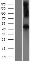 FBXL2 Human Over-expression Lysates NM_001171713