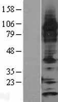 Thioredoxin 2 (TXN2) Human Over-expression Lysates NM_012473