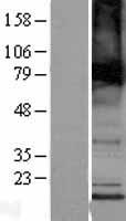 TMEM184B Human Over-expression Lysates NM_012264