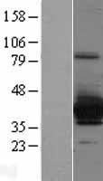 SULT4A1 Human Over-expression Lysates NM_014351