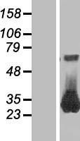 RAB26 Human Over-expression Lysates NM_014353