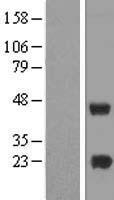 METTL7A Human Over-expression Lysates NM_014033
