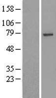 USP49 Human Over-expression Lysates NM_018561