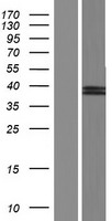SUMF2 Human Over-expression Lysates NM_001042469