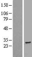 TMEM186 Human Over-expression Lysates NM_015421