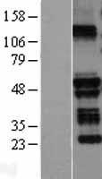 TRIM58 Human Over-expression Lysates NM_015431