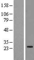 EEF1AKMT3 Human Over-expression Lysates NM_015433