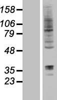 DORFIN (RNF19A) Human Over-expression Lysates NM_183419