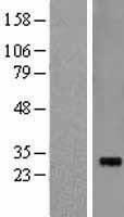 Pirh2 (RCHY1) Human Over-expression Lysates NM_015436