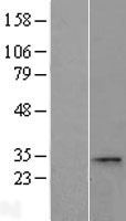 ls025901 ccdc28a human over expression lysates nm 015439 wb testing 1