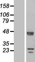 DPCD Human Over-expression Lysates NM_015448