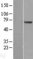 POT1 Human Over-expression Lysates NM_015450